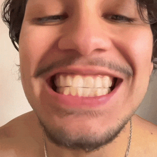 Whitening strips in use